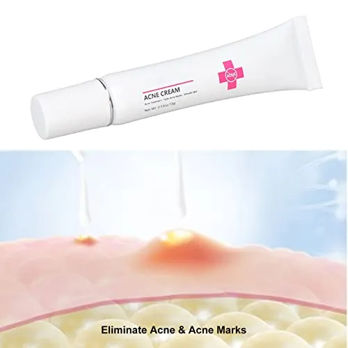 15g Acne Removal Cream, Moisturizing Acne Scars Treatment Cream Skin Repairing Cream, Fades Acne Spot, stubborn Scars, Pigmentation & Blemish