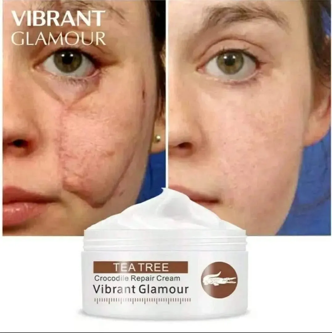 Acne & Scar Cream