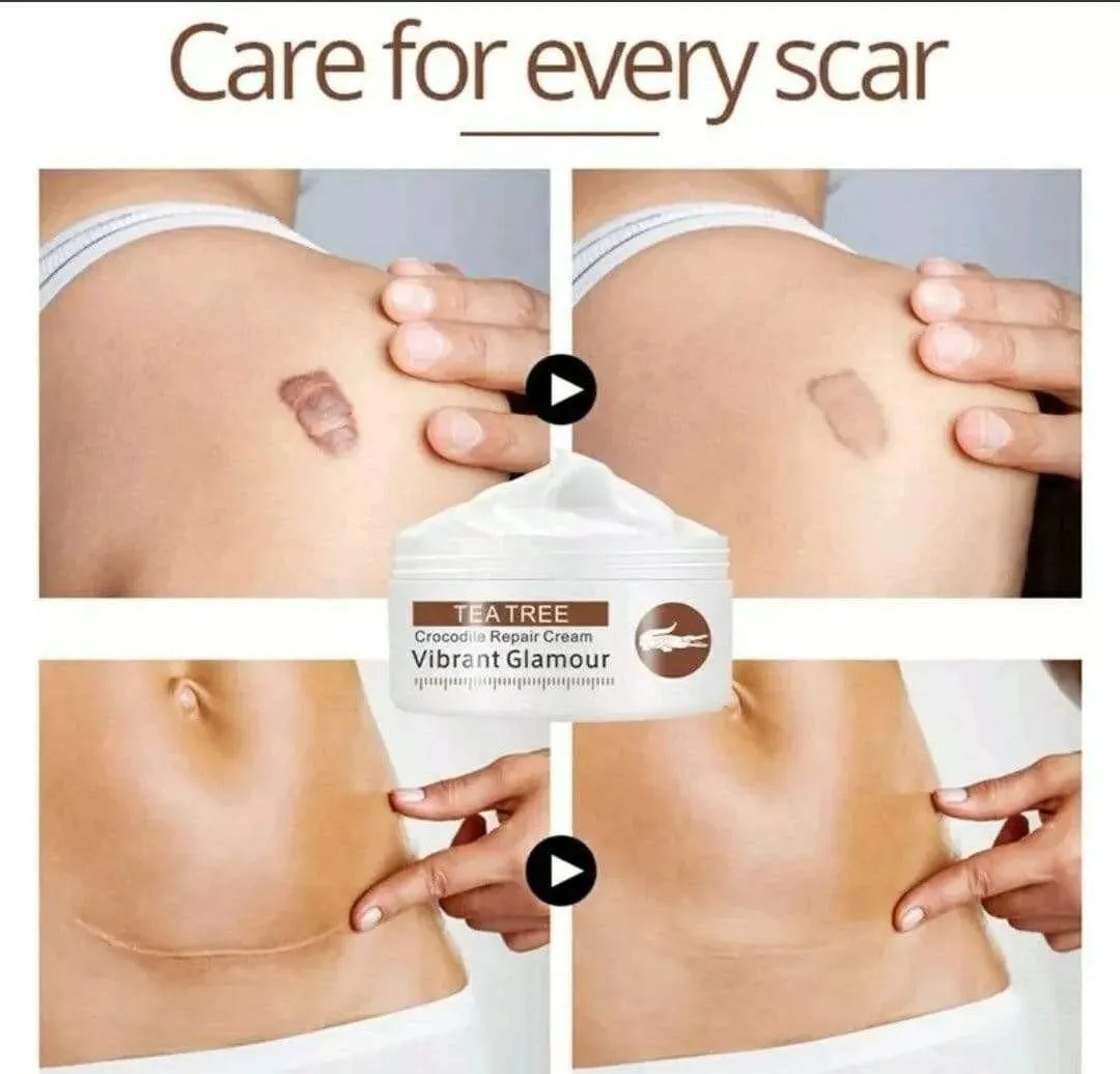 Acne & Scar Cream