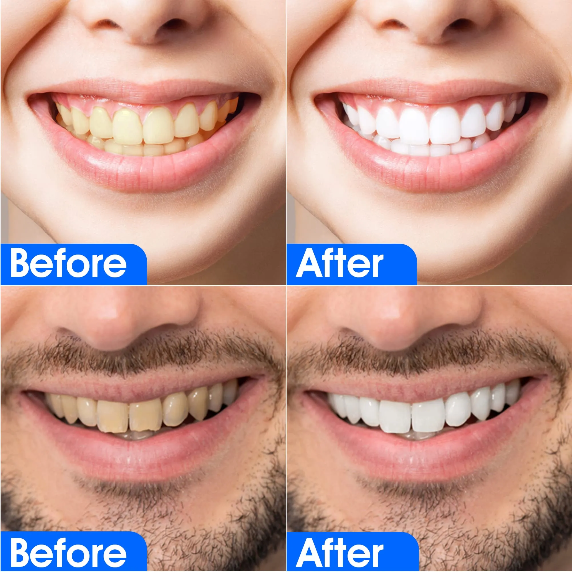 Advanced 5D Teeth Whitening Strips for Sensitive Tooth 14 Sessions for 5D White