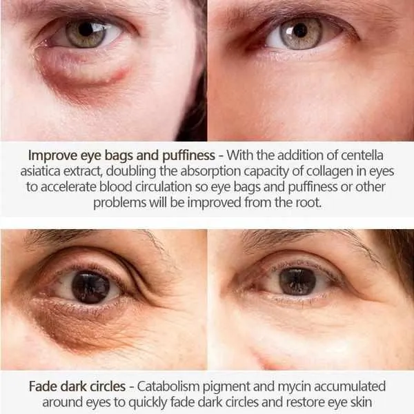 Anti-Aging Wrinkles Eye Cream With Hyaluronic Acid Moisturizing, Dark Circles Puffiness Remover