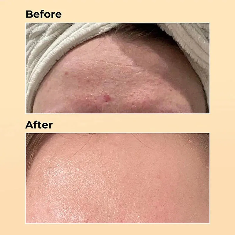 Anti-wrinkle Essence Face Cream Repairing Lift Firm