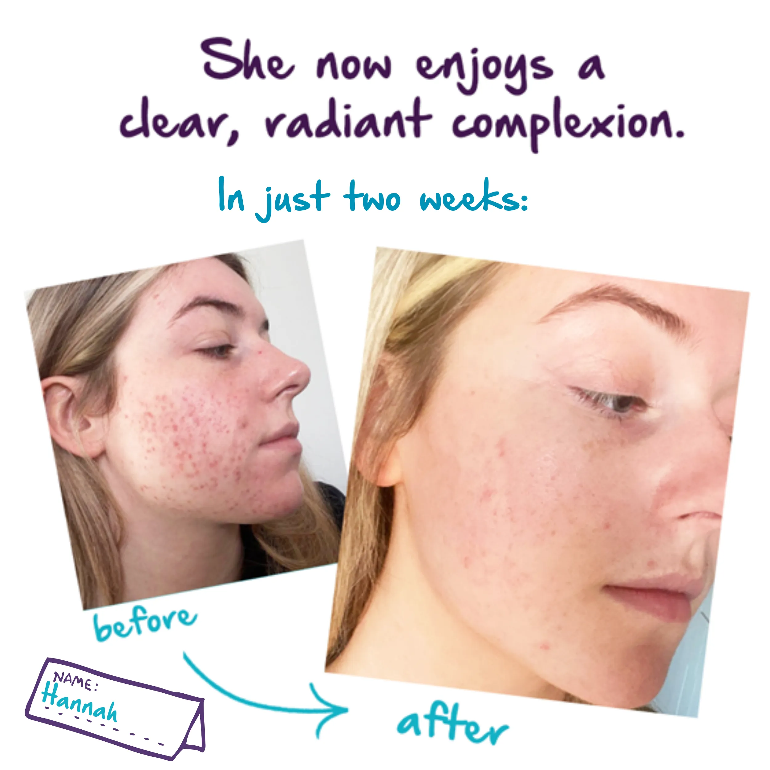 Bare Necessity Kit - 3 step routine