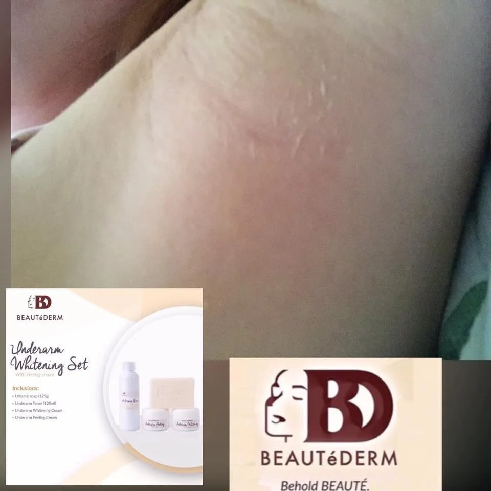 Beautederm Underarm Whitening Set