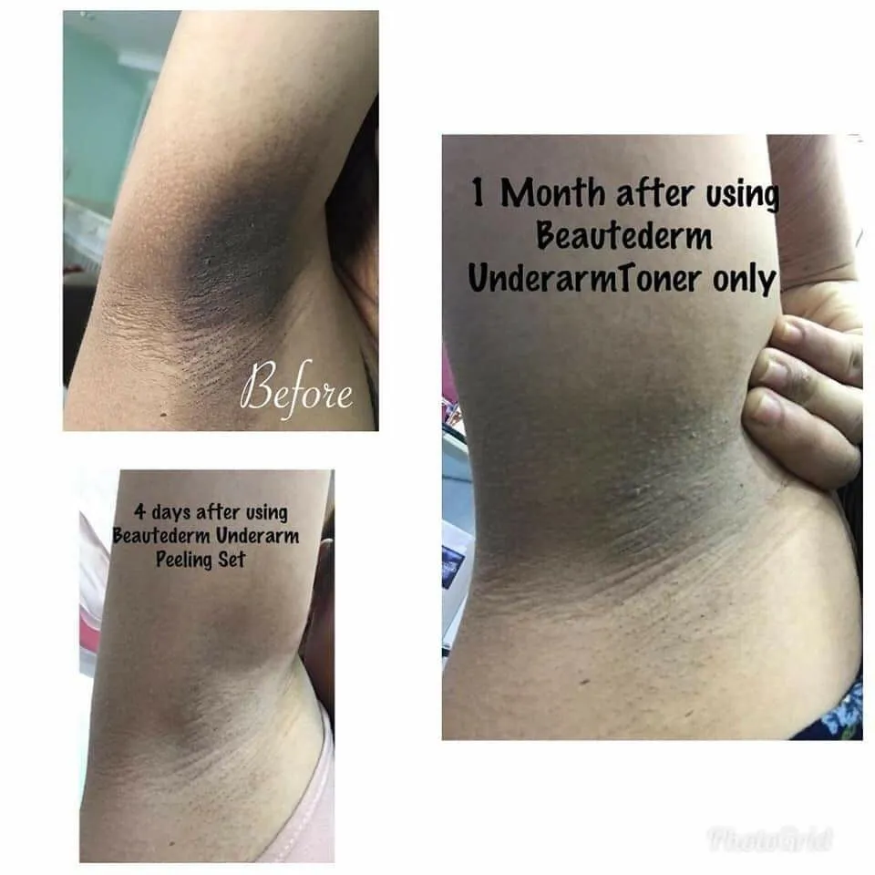 Beautederm Underarm Whitening Set