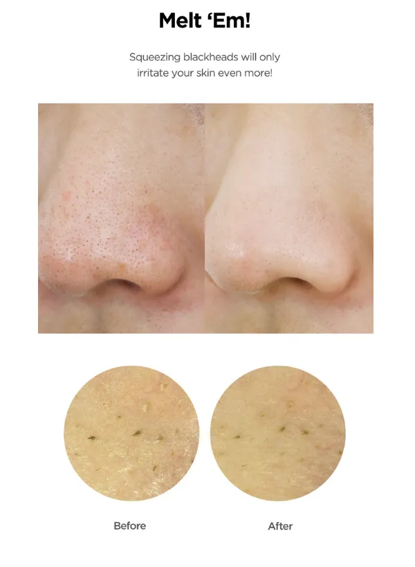 Blackhead Care 3-Step Set(Cleansing Oil   Toner   Cream)