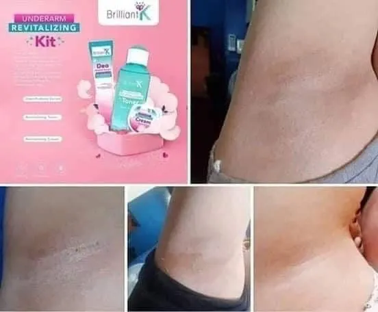 Brilliant K Underarm revitalizing kit