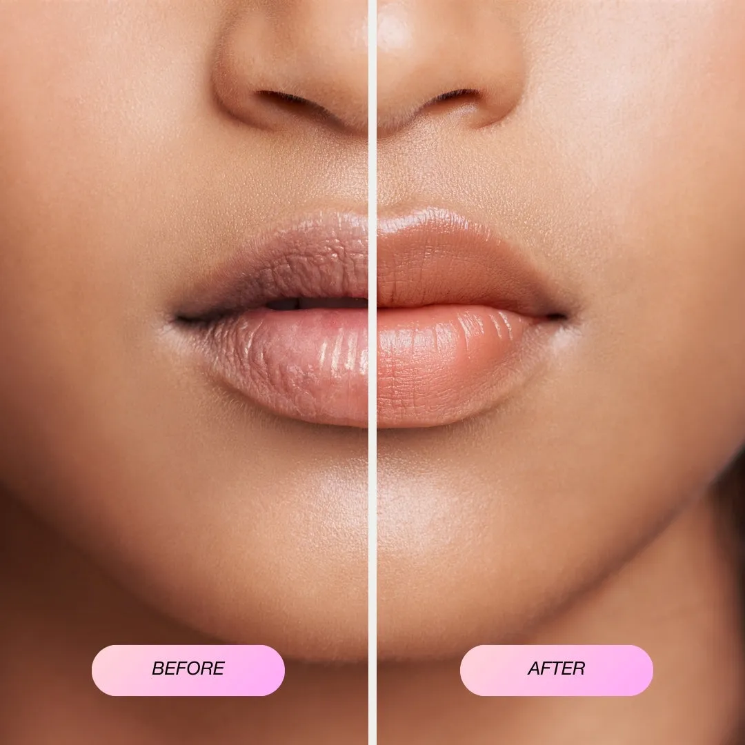 Bundle 10 x Collagen Lip Masks