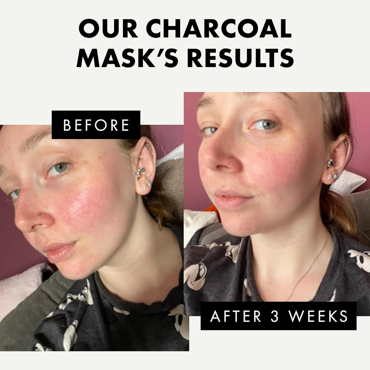 Charcoal Peel Off Mask Facial Cleansing Acne Blackhead Control Deep Clean Pore 75ml