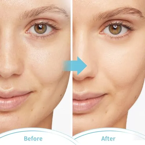 CONBELLA Cold Face Eye Masks Ice Face Mask Hot Cold Compress For Dark Circles, Puffiness, Migraines, Headache, Stress, Redness, Cooling Face Masks For Women Man, Skin Care
