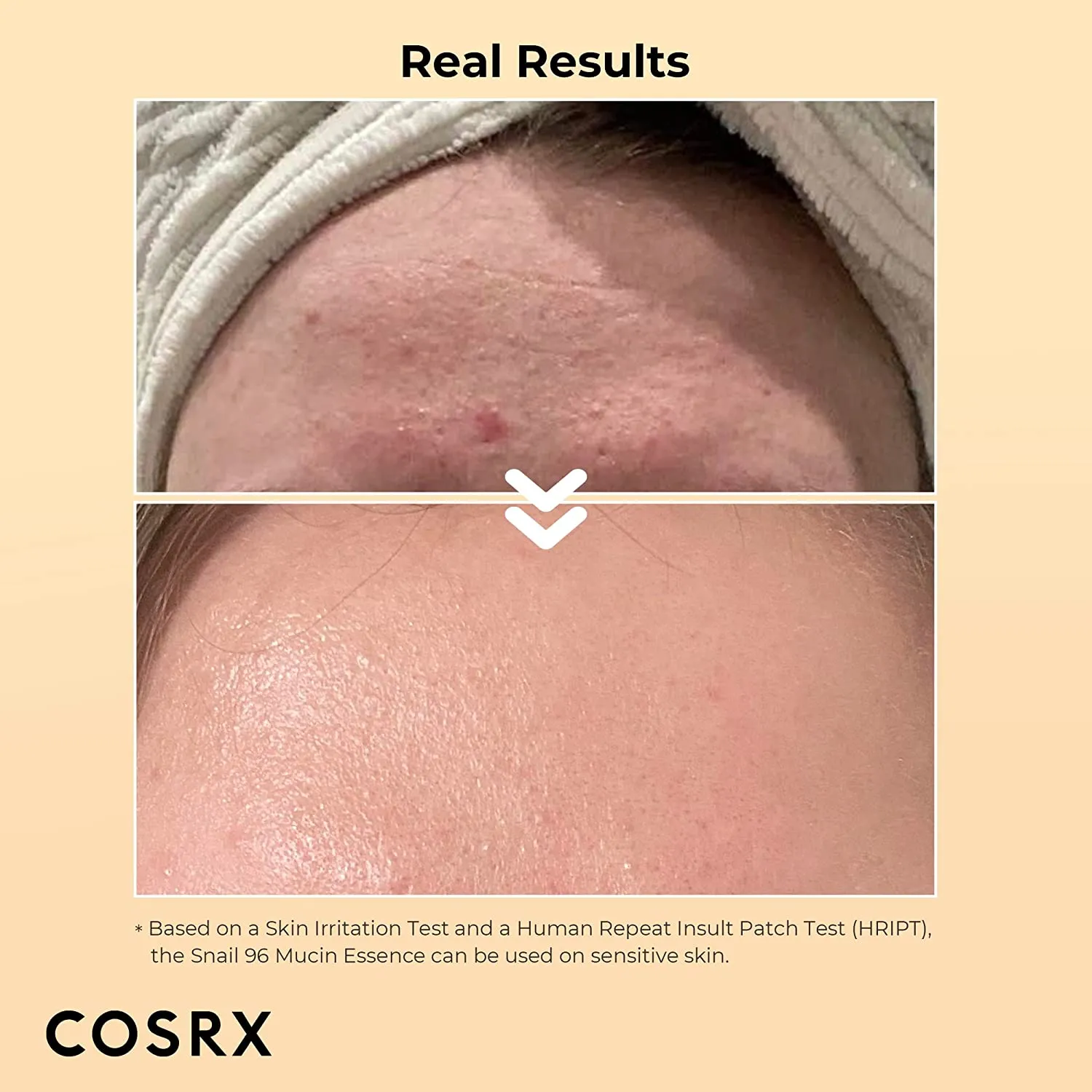 COSRX - Advanced Snail 96 Mucin Power Essence - 100ml