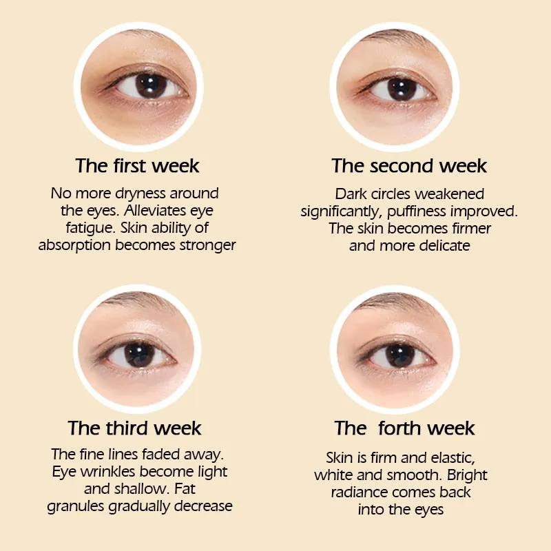 Crocodile Anti-Aging Eye Cream Remove Dark Circles Puffiness Lighten Fine Lines Whitening Moisturizing Eye Care