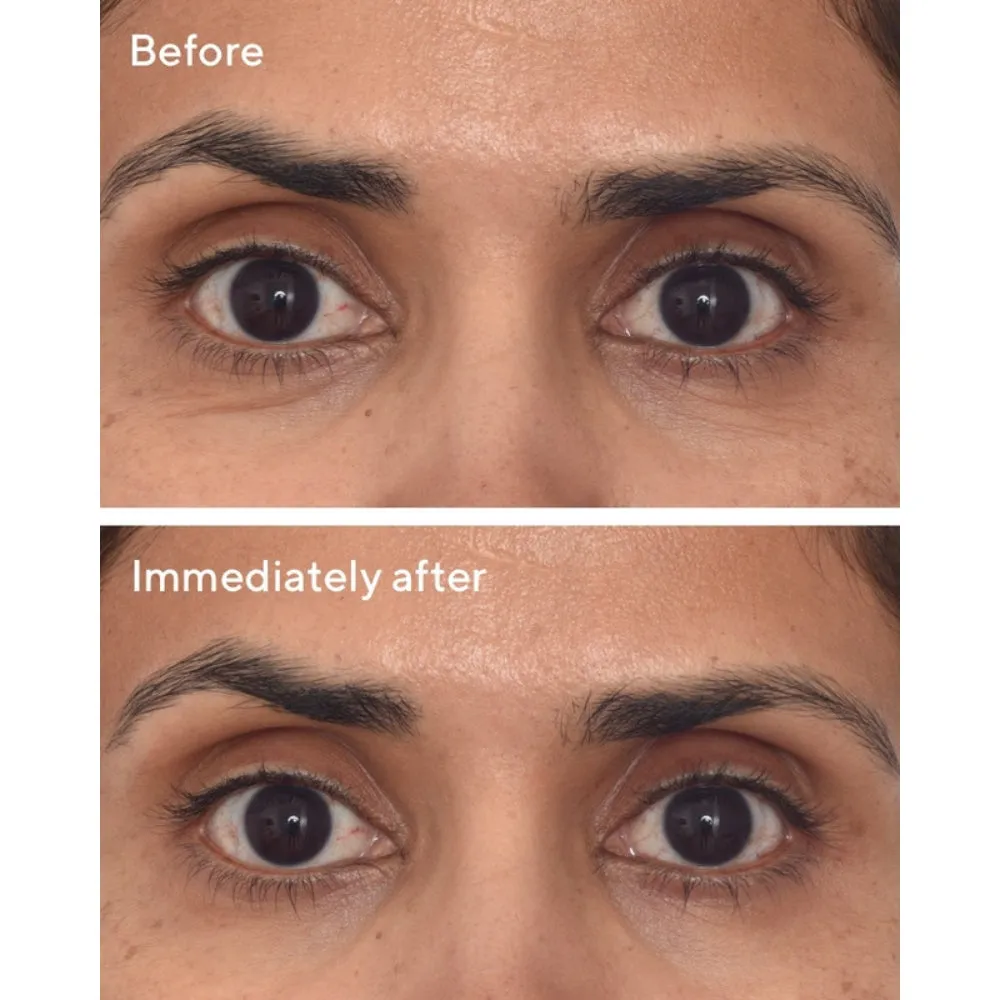 Dr. Zion x Murad Retinol Youth Renewal Eye Masks