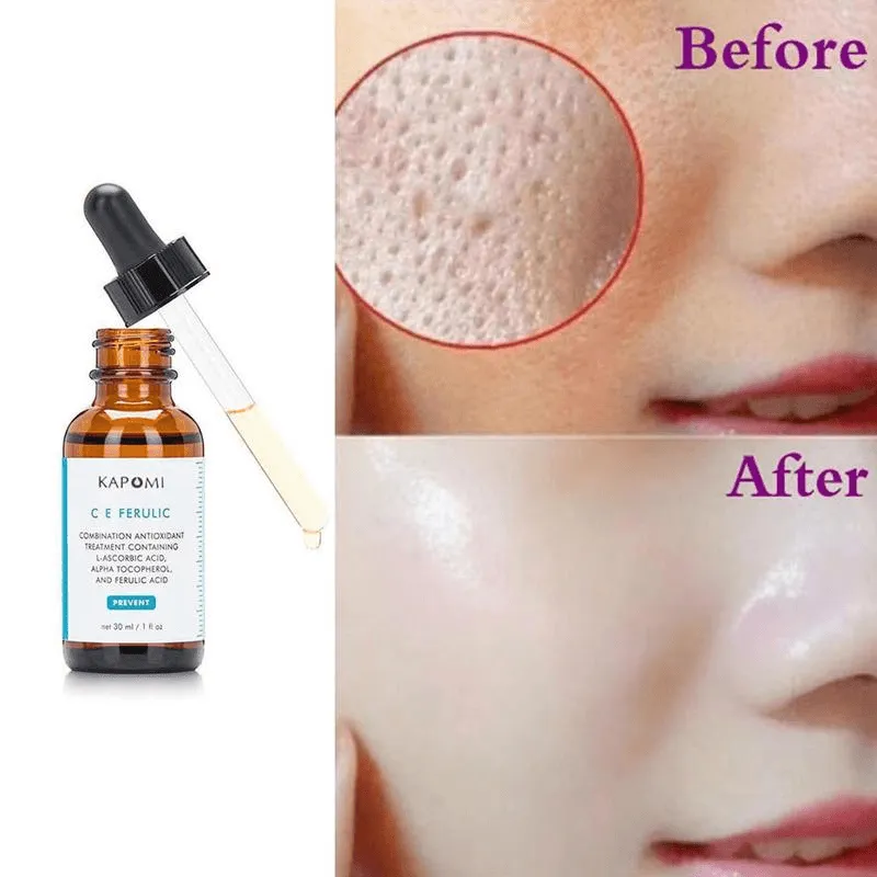 Facial Vitamin Repair Antioxidant Spot Whitening Essence