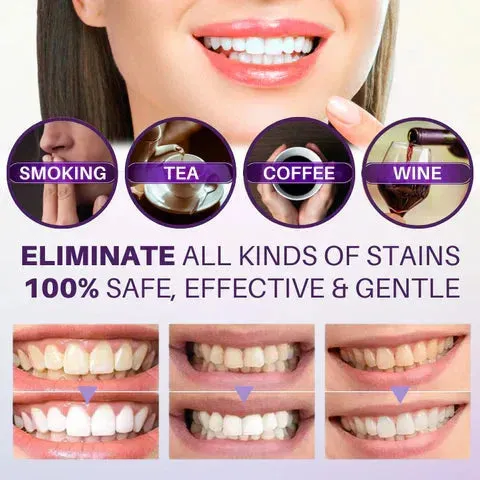 Hismile V34 Colour Corrector | Tooth Stain Concealer & Teeth Whitening Booster | Purple Toothpaste for Colour Correction.