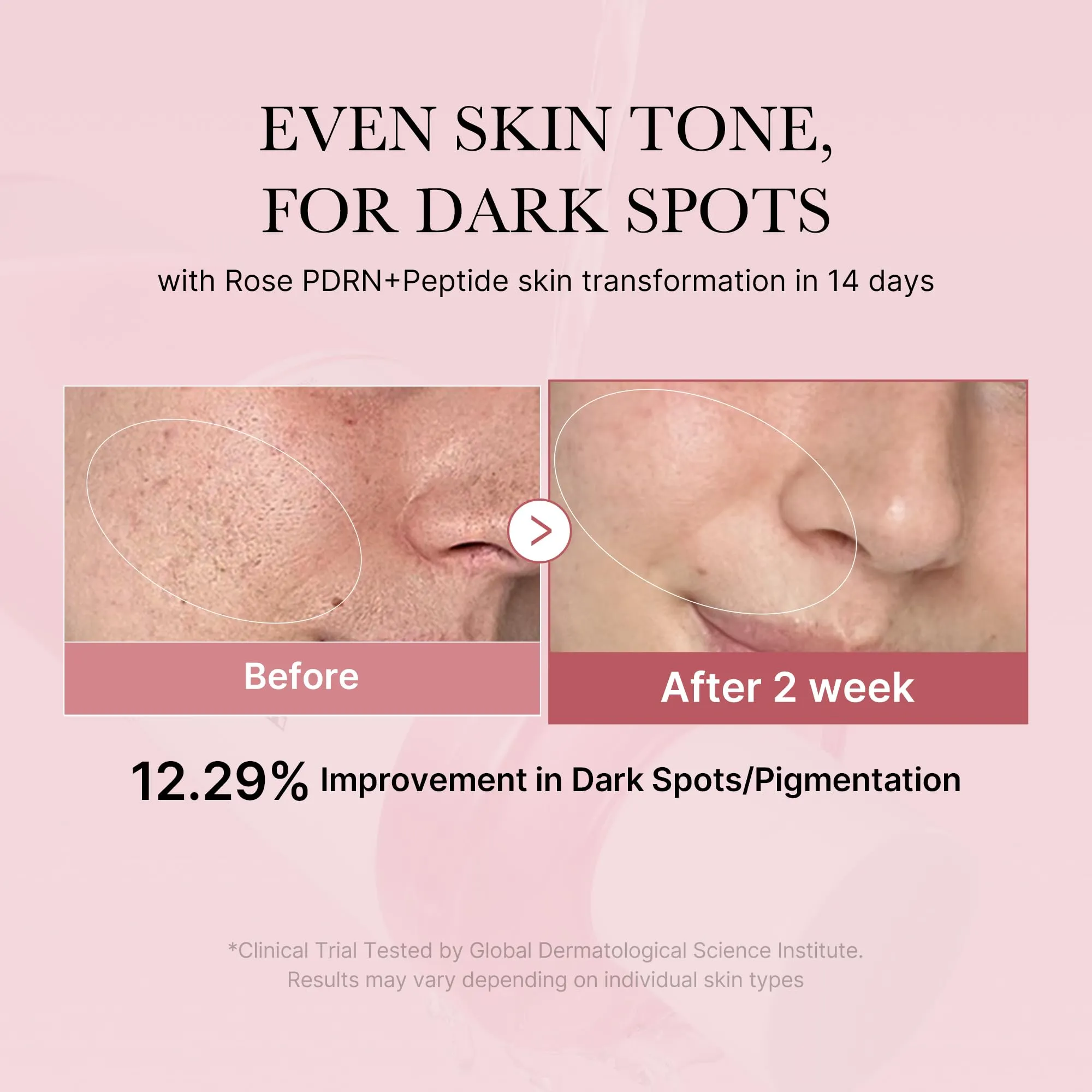 Medicube PDRN Pink Cica Soothing Toner