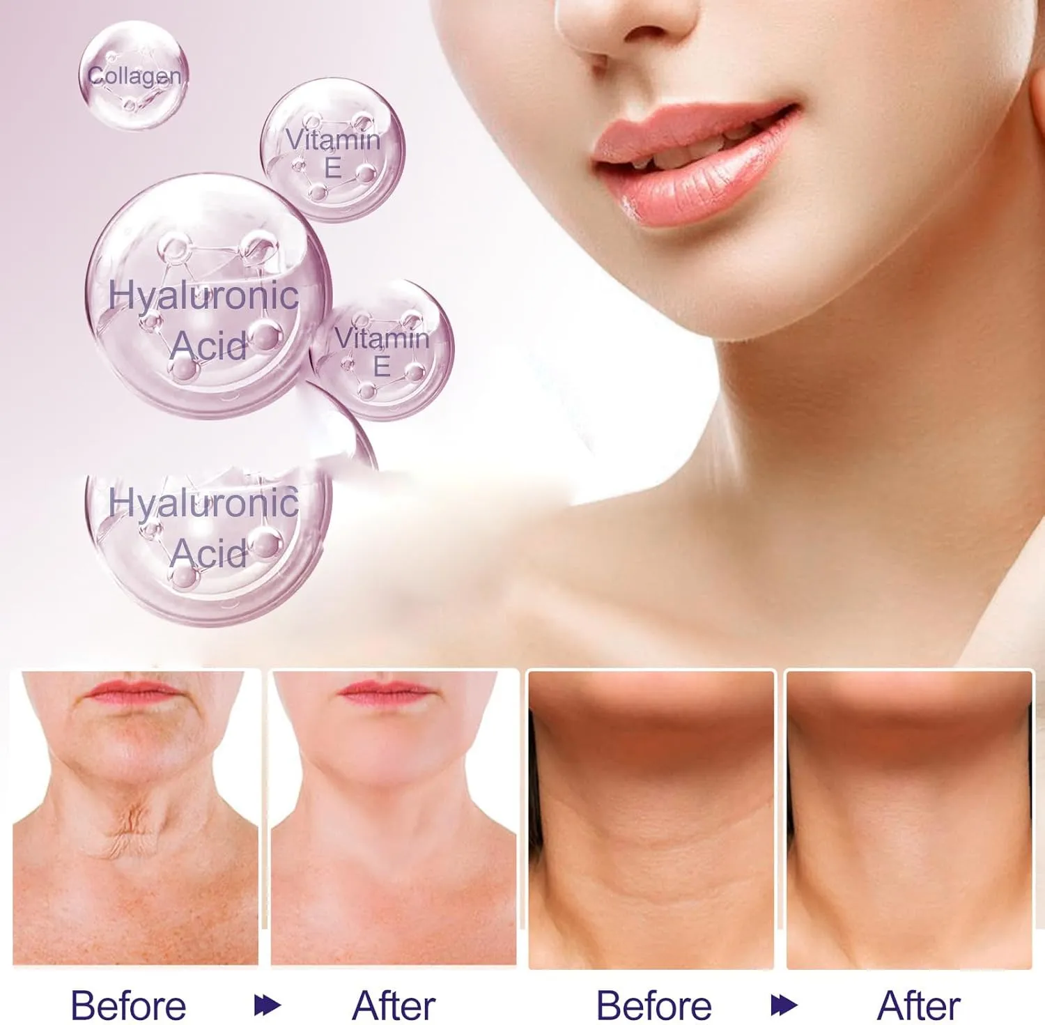 NEW HIDRUO2024 New Pure Tighten & Lift Neck Cream,Tighten and Lift Neck Cream, Skin Care Moisturizer Face Cream,Eliminates Wrinkles Repairs Firming (1 PCS)