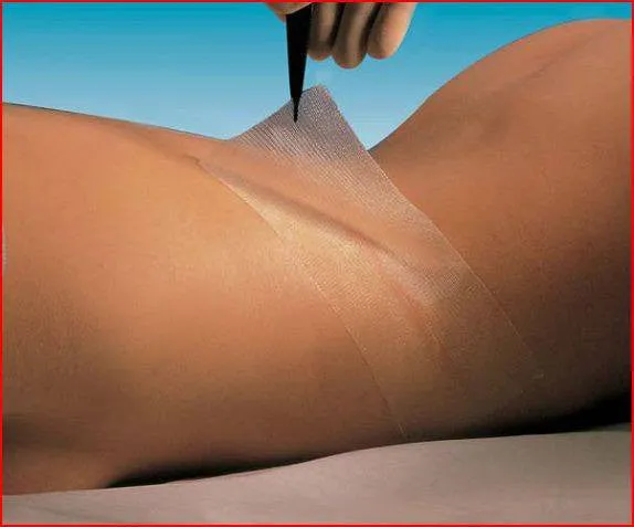 Oil Emulsion Impregnated Adaptic Non-Adhering Dressings 3 inch x 8 inch (Each)