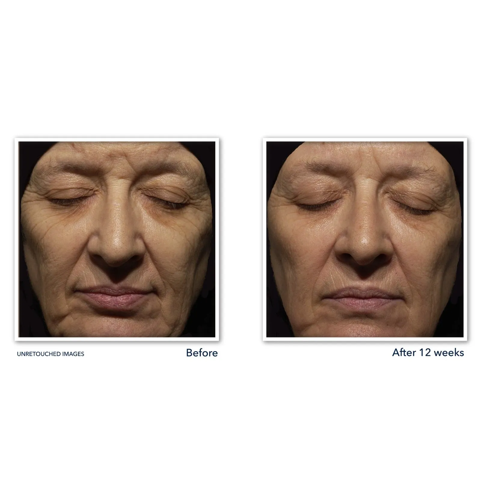 RETINOL CORREXION® Deep Wrinkle Night Cream