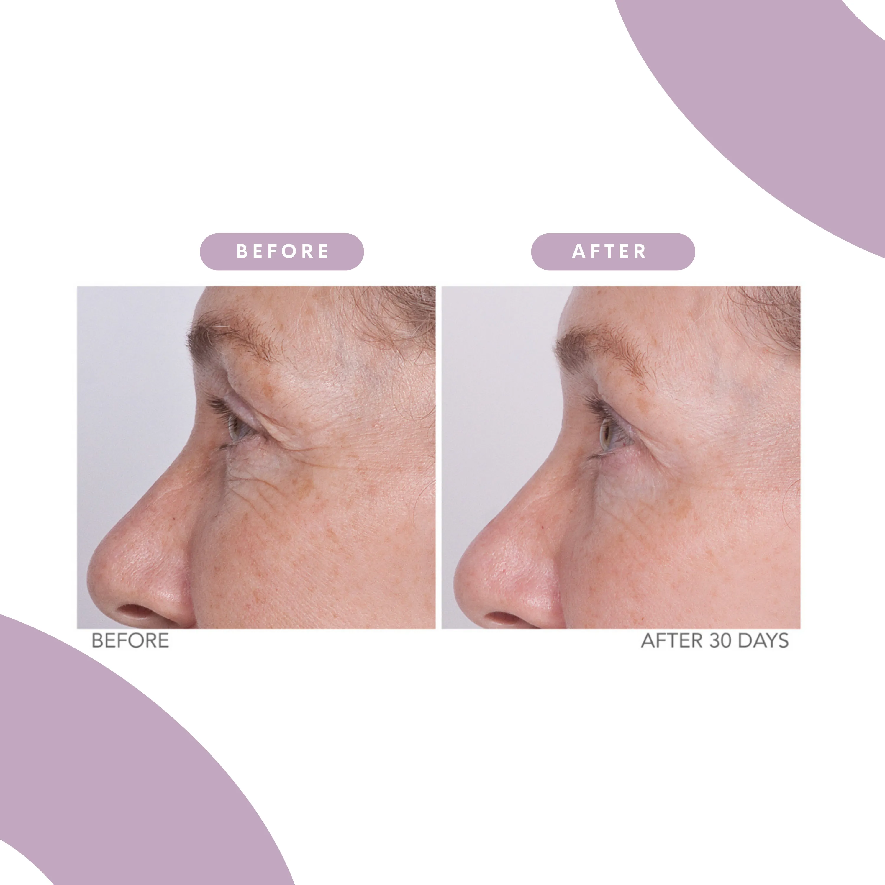 Reverse Lift Eye Cream 1 fl.oz