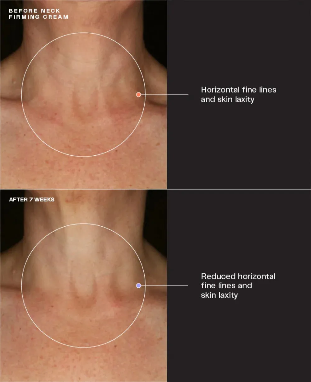 SENTE Neck Firming Cream