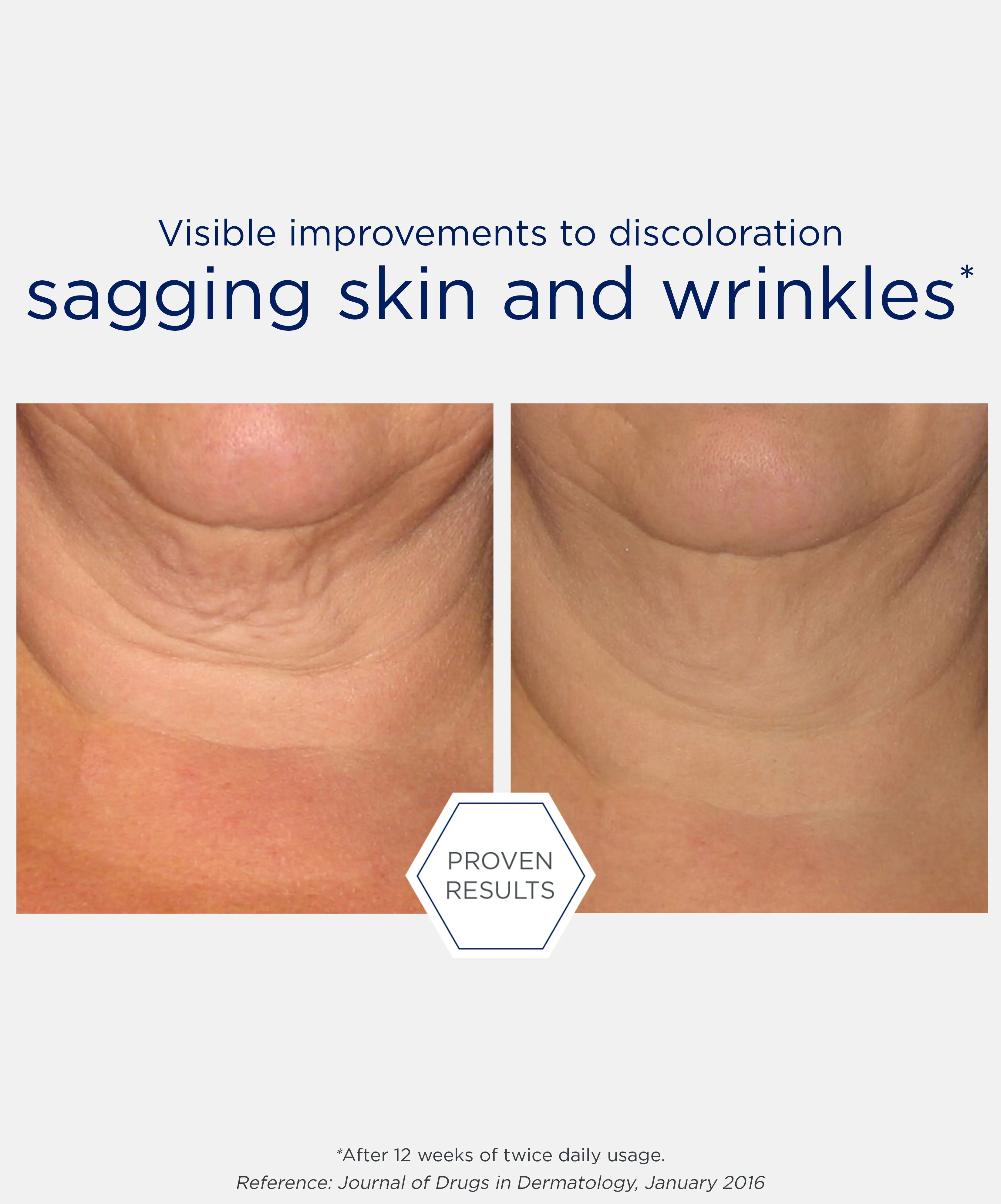 Skin Active Triple Firming Neck Cream