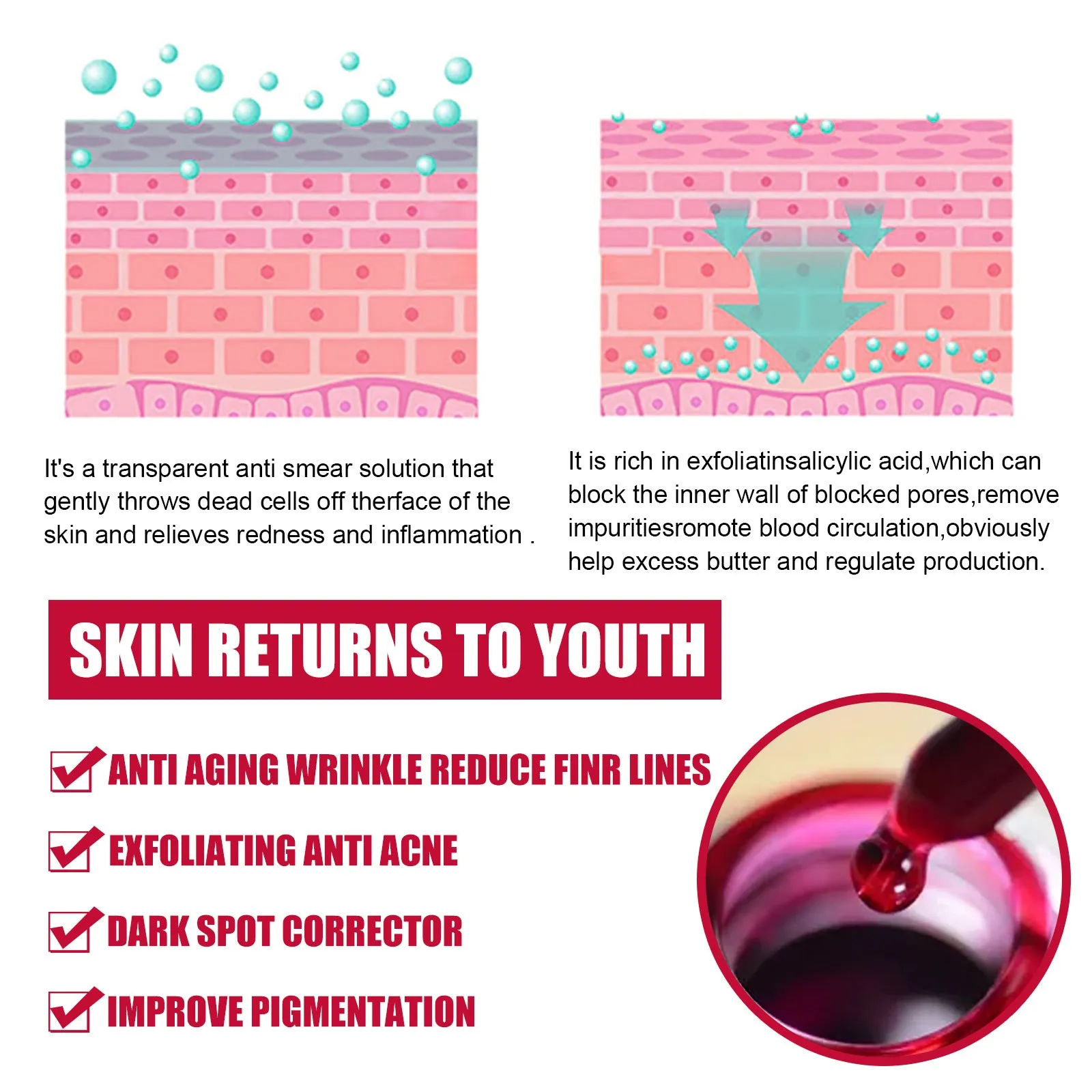 Tartaric Acid Salicylic Acid Essence Exfoliating Closed Blackhead Acne Pore Shrinking Essence