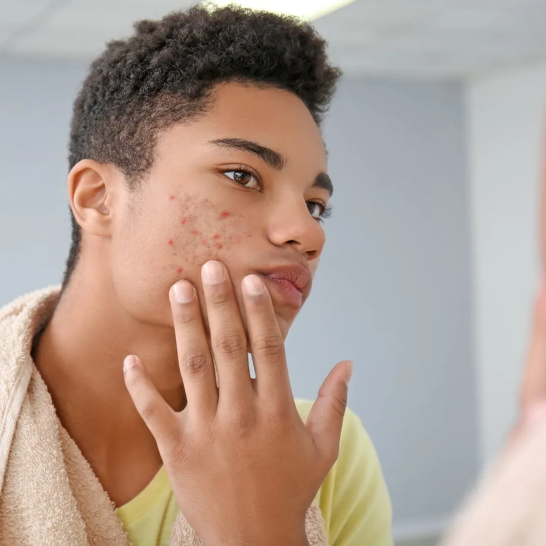 Teen Skin Care 101