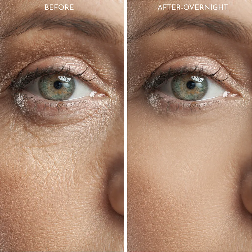 Truly Clear Wrinkle Fighting Silicone 3 Piece Face Set