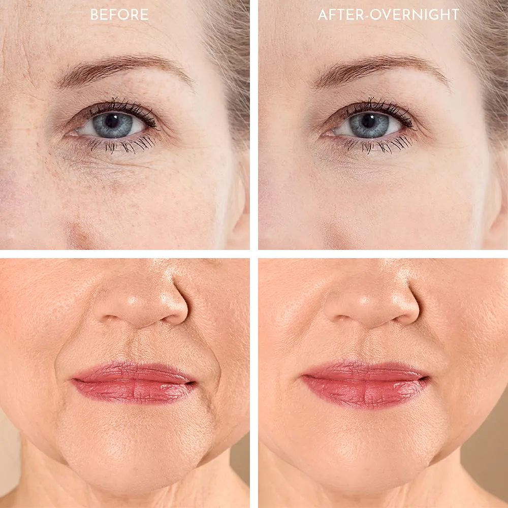 Truly Clear Wrinkle Fighting Silicone 3 Piece Face Set